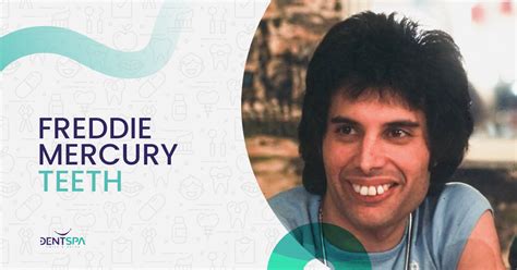 Iconic As the Bohemian Rhapsody: Freddie Mercury Teeth | DentSpa