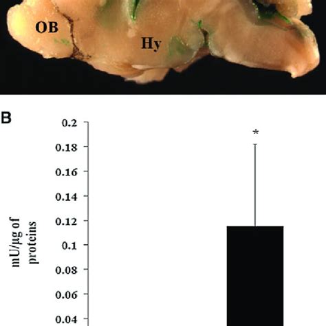 Gross X Gal Staining Of Helper Dependent Adenoviral HDAd Injected