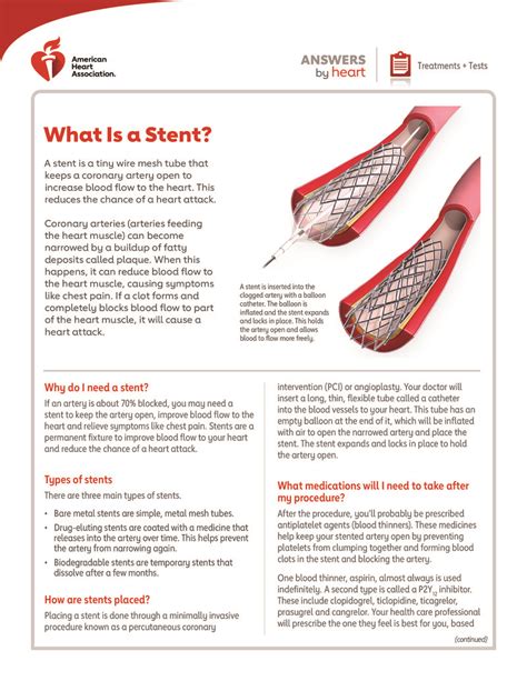 Text - What Is a Stent? - HealthClips Online