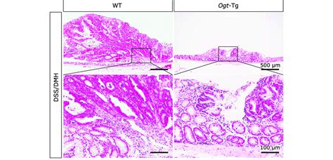 Hematoxylin And Eosin Hande Staining Of Colonic Tissues In Download Scientific Diagram