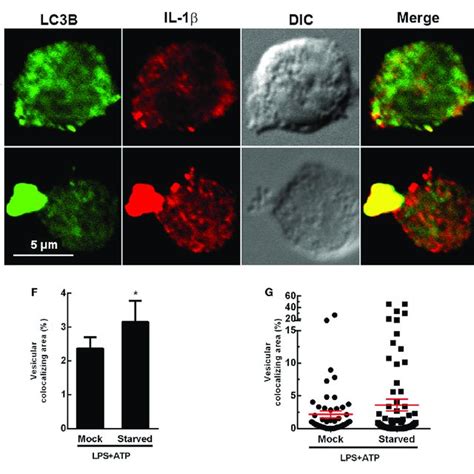 Fluorescence Distribution Of Interleukin 1β Il 1β And Lc3b In Lps Download Scientific