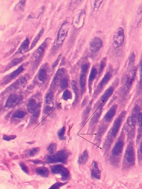 Basal layer of the epidermis =الطبقة القاعدية في البشرة