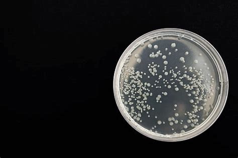 Coliform Bacteria - Javatpoint