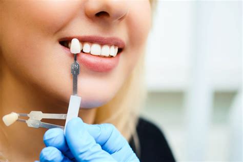 Common Causes Of Tooth Discoloration Dentist In Washington DC