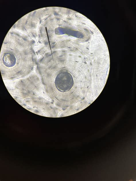 bone histology - osteon Diagram | Quizlet