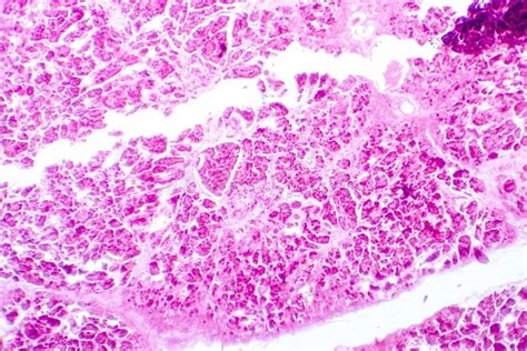 Histology Of Human Pancreatic Tissue Stock Photo Image Of Microscopic