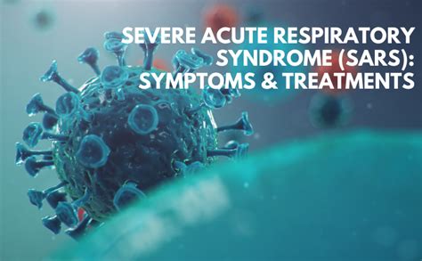 Severe Acute Respiratory Syndrome Sars Symptoms And Treatments