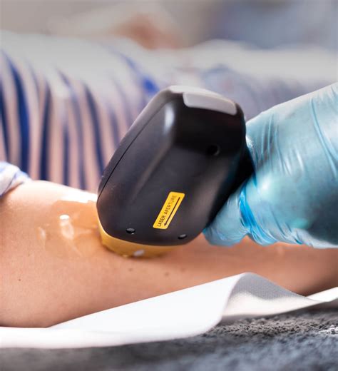 Soprano Ice Titanium Laser Hair Removal – Cindy Knight Clinic