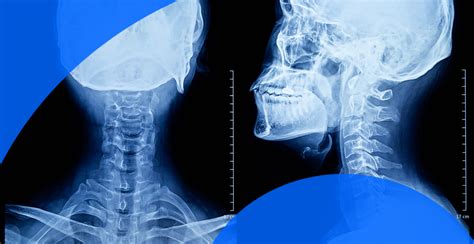 How To Read An X Ray Report Pockethealth