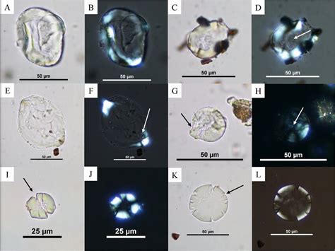 Damaged starch grains probably as a result of mechanical and cooking ...