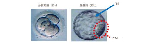 着床前診断（pgt）について④ Pgt A（着床前胚染色体異数性検査）実際の流れについて 英（はなぶさ）ウィメンズクリニックのハナブロ