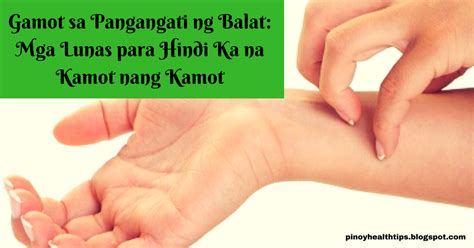 Gamot Sa Pangangati Ng Balat Mga Lunas Para Hindi Ka Na Kamot Nang Kamot