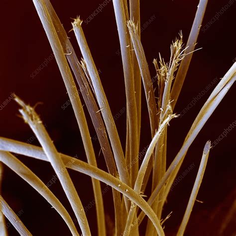 Magnified Split Ends Under Microscope Micropedia