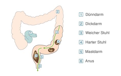 Antwort Was Kann Man Bei Harten Stuhlgang Bei Kindern Machen Weitere