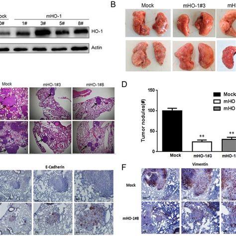 Overexpression Of Ho 1 Inhibits Lung Metastasis Of 4t1 Cells The