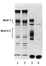 Figure Sodium Dodecyl Sulfatepolyacrylamide Gel Electrophoresis