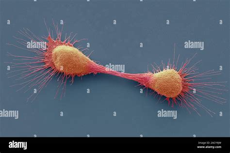 Dividing Prostate Cancer Cells Coloured Scanning Electron Micrograph