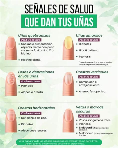 Pin En Nail Designs Salud De Las U As Enfermedades En Las U As