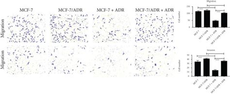 Proliferation Cell Cycle Progression Invasion And Migration Were