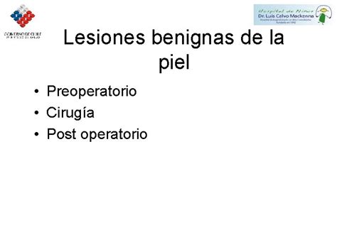 Ciruga De Lesiones Benignas De La Piel Y