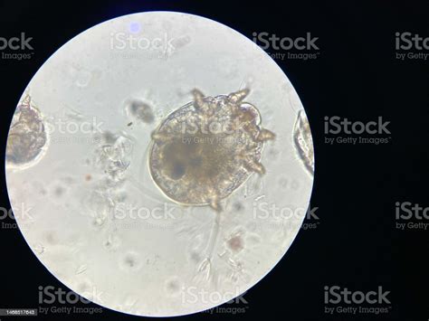 Notoedres Cati Under The Microscope Notoedric Mange Also Referred To As Feline Scabies Stockfoto