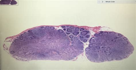 Lymph Node Diagram Quizlet