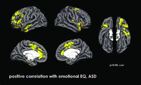 Areas Showing Positive Correlation With Emotional Empathy Quotient Eq