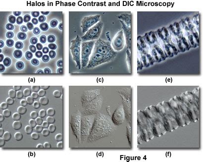 Differential Interference Contrast - Comparison of Phase Contrast and ...