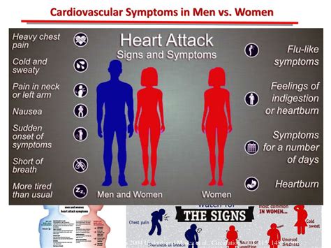 PPT - Heart Disease Clinical Signs and Symptoms PowerPoint Presentation