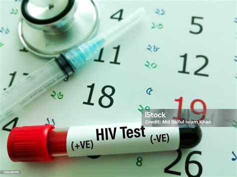 Blood Sample In A Tube With Label Hiv On A Monthly Planner Appointments