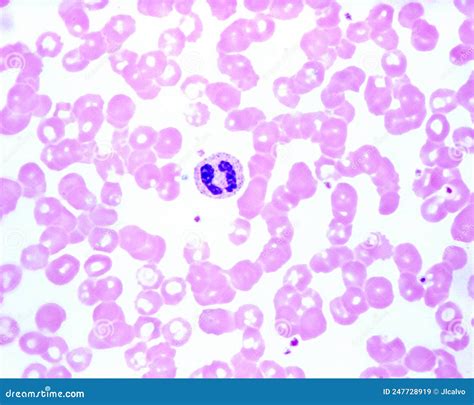 Human Blood Smear Neutrophil Stock Image Image Of Polymorphonuclear