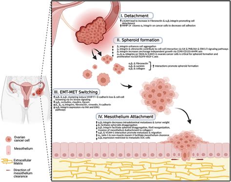 A Schematic Model Of Ovarian Cancer Dissemination And The Role Of