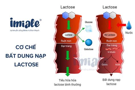 Enzyme Lactase Là Gì Công Dụng Và Lưu ý Khi Sử Dụng