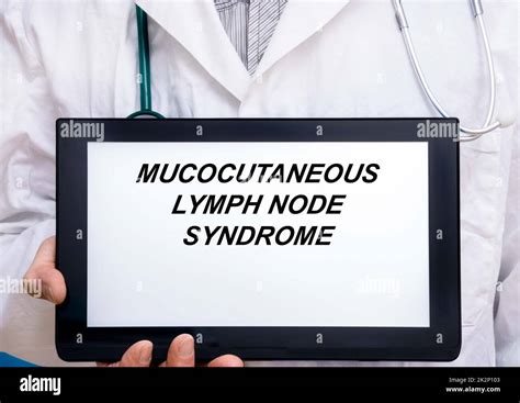 Mucocutaneous Lymph Node Syndrome Doctor With Rare Or Orphan Disease