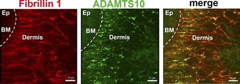 Co Localization Of Adamts10 With Fibrillin 1 In Human Skin A Download Scientific Diagram