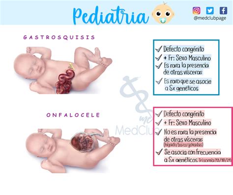 Onfalocele Y Gastrosquisis Flashcards