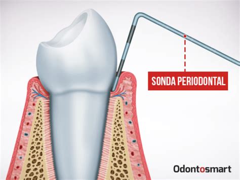 10 Conceptos Básicos De Periodoncia Para Estudiantes De Odontología