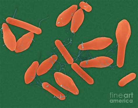 Clostridium Botulinum 9 By Science Photo Library