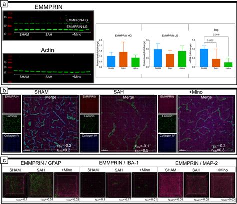 EMMPRIN Protein Level Gene Expression And Colocalization With