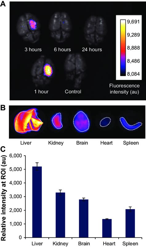 Ex Vivo Fluorescence Imaging Of Biodistribution Of The Nanoparticles In