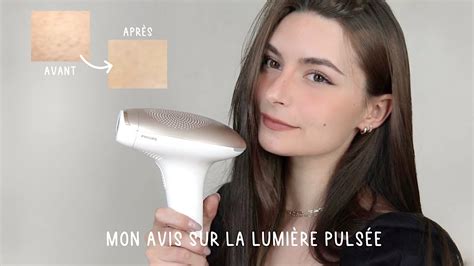 mon avis sur la lumière pulsée photos avant après YouTube