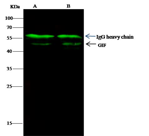 Intrinsic Factor Antibody Guideline Sino Biological