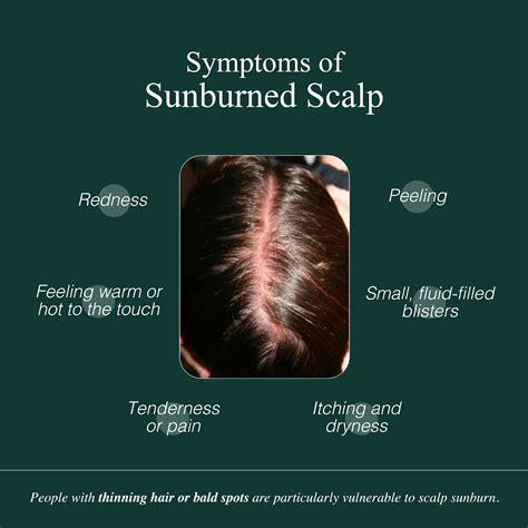 Sunburned Scalp: Protecting Your Scalp from the Sun