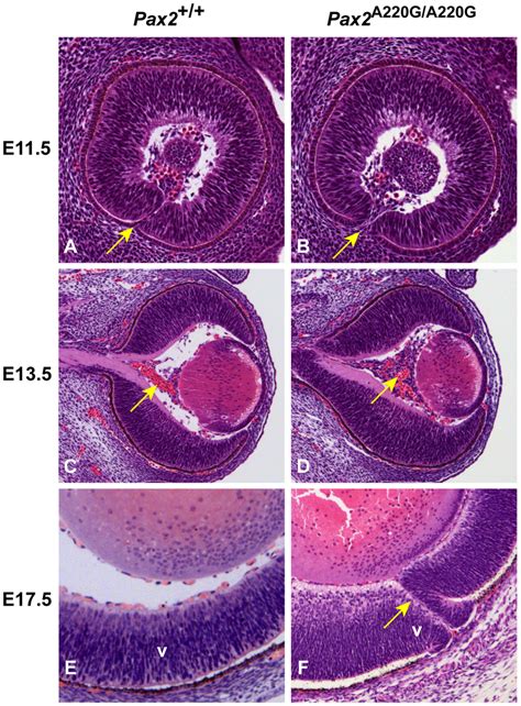 Histologic Sections Of Pax And Pax A G A G Mouse Eyes At Three