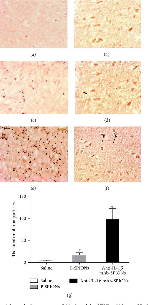 Figure 2 From Value Of Functionalized Superparamagnetic Iron Oxide