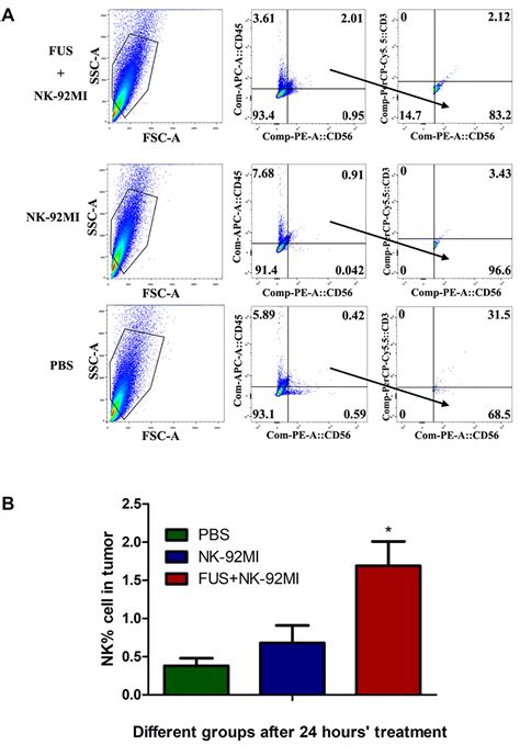 Frontiers Focused Ultrasound Improves Nk 92mi Cells Infiltration Into