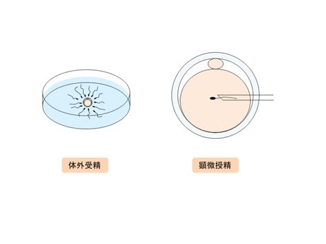 生殖補助医療（体外受精、顕微授精） 東京hartクリニック