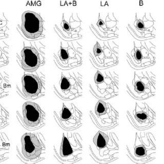 Histological reconstruction of amygdala subnuclei lesions. The black ... 