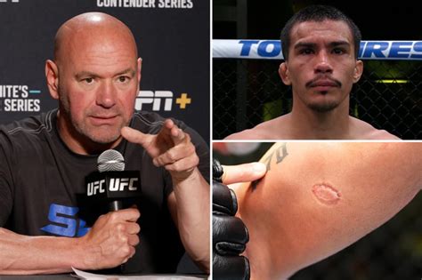 Now You Get Cut Dana White Removes Igor Severino From Roster After