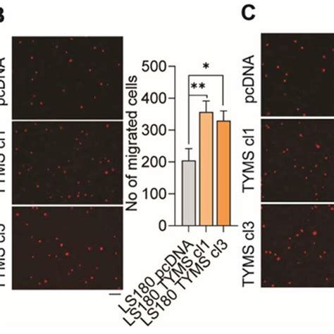 TYMS Overexpression Cells Exhibited An Increased Invasive Phenotype